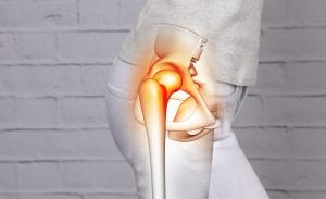Hip Pain Treatment in Brick by one of the best chiropractors in Brick, NJ